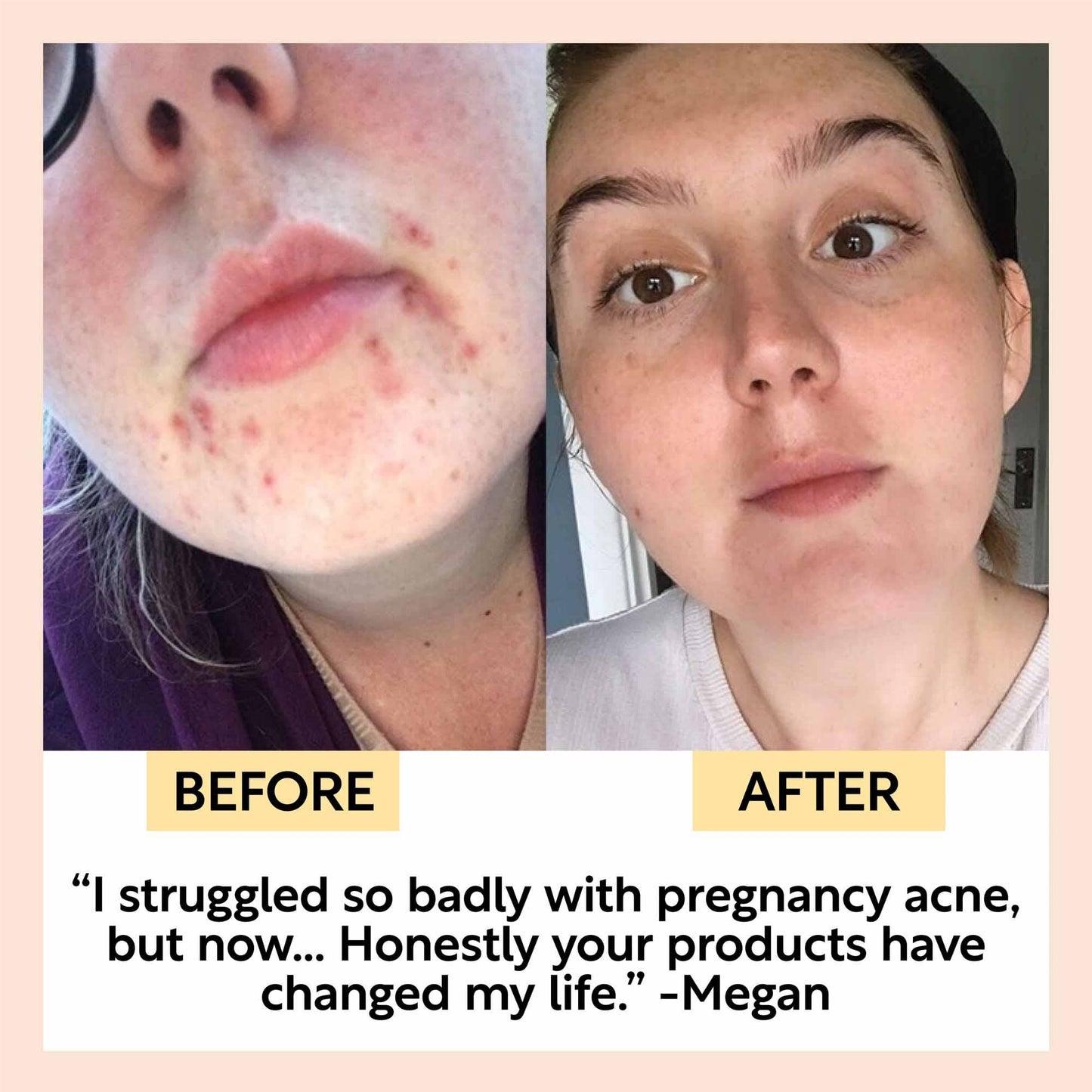 Face Moisturizer | Vitamin E, Aloe Vera | UpCircle