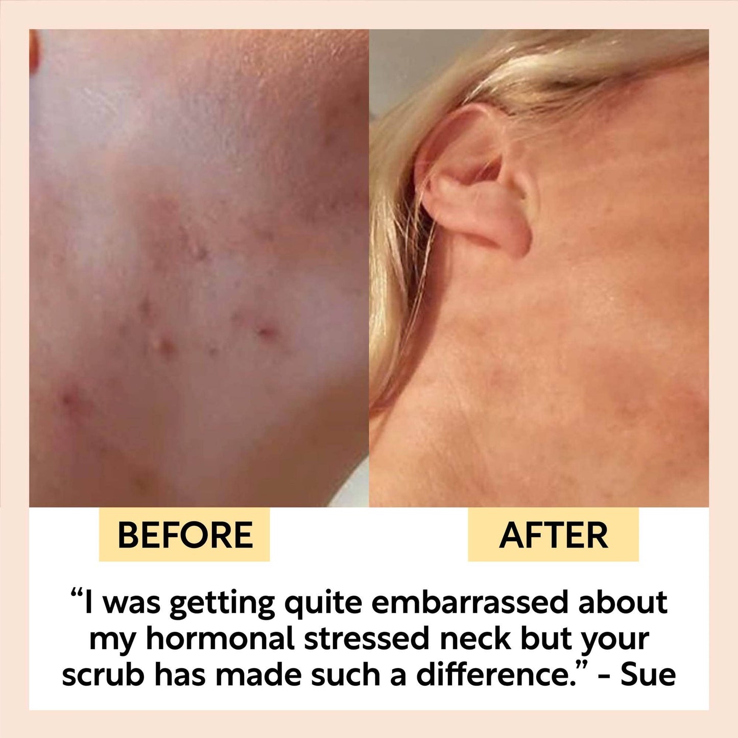 Vegan Face Scrub | Coffee + Rosehip (Citrus blend)| UpCircle