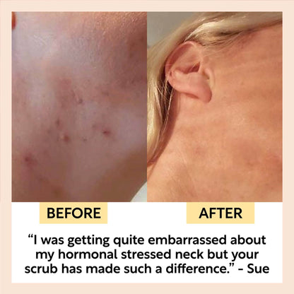 Vegan Face Scrub | Coffee + Rosehip (Citrus blend)| UpCircle